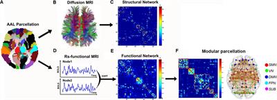 Disrupted Module Efficiency of Structural and Functional Brain Connectomes in Clinically Isolated Syndrome and Multiple Sclerosis